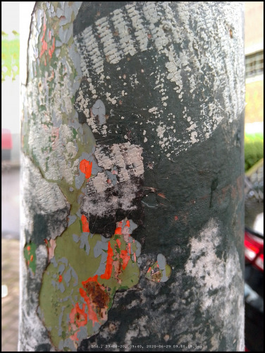 Gipsverband